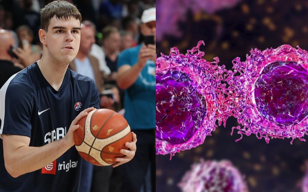 Simptomi raka testisa od kojeg boluje Nikola Topić | Stil