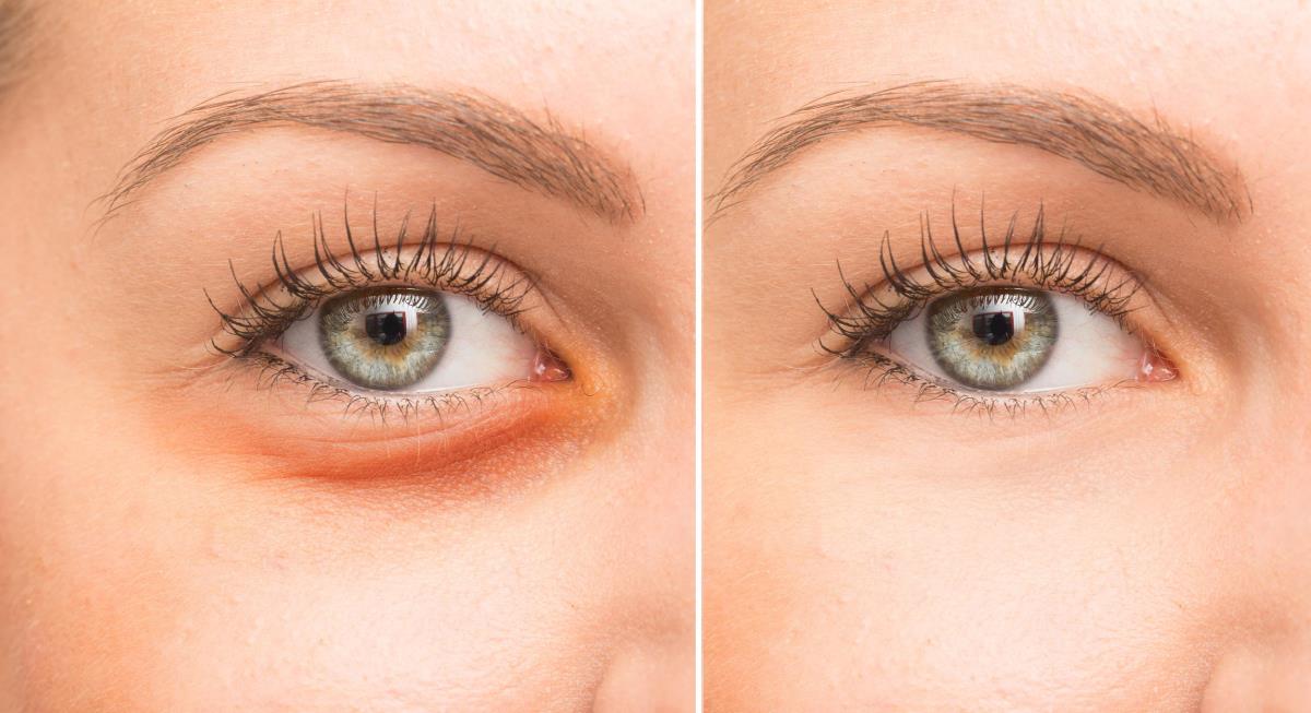 3 navike pre spavanja koje mogu da smanje podočnjake