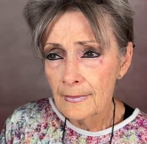 Plastični hirurg, za pacijente uzima samo babe i od njh pravi devojke: 70-godišnje bake preko noći pretvara u žene od 40. godina