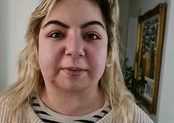 Imala sam ovaj simptom jednog od najagresivnijih karcinoma, lekari tvrdili da je jača prehlada: Mesecima su me lečili pogrešno, evo kako sam se izvukla