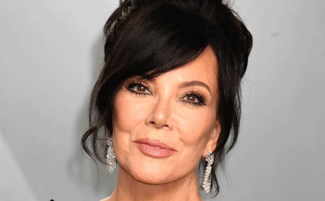 "Lice Kris Džener počelo je da popušta, bes kipti iz nje": Godinu dana nakon što je spiskala 100 000 evra na fejslifting, već sve puca