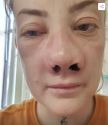 2025-06-04 14_26_33-FOTO Glazbenica otišla u Tursku ugraditi zubne implantate, a onda je počeo horor.png
