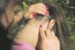 stock-photo-people-looking-at-wood-tick-embedded-in-human-skin-190940576.jpg