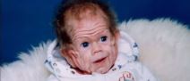 20240505-12-13-59medical-mystery--boy-living-with-rare-excess-skin-condition---60-minutes-austral.jpg