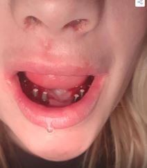 2025-06-04 14_25_38-FOTO Glazbenica otišla u Tursku ugraditi zubne implantate, a onda je počeo horor.png