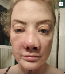 2025-06-04 14_26_07-FOTO Glazbenica otišla u Tursku ugraditi zubne implantate, a onda je počeo horor.png