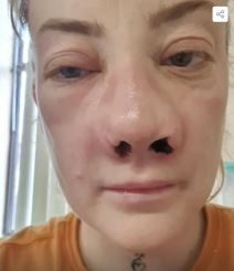 2025-06-04 14_26_33-FOTO Glazbenica otišla u Tursku ugraditi zubne implantate, a onda je počeo horor.png