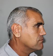 naser estet.png