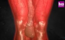 2025-11-06 14_21_16-The Man With The Half-Metre Penis - YouTube.png