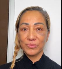 plastična hirurgija20.jpg