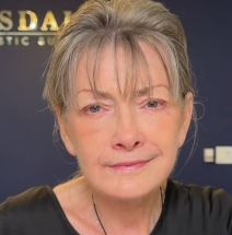 plastična hirurgija17.jpg