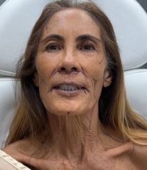 plastična hirurgija7.jpg