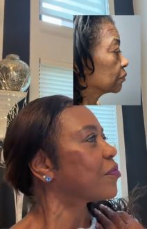 plastična hirurgija4.jpg