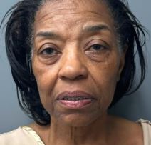 plastična hirurgija2.jpg