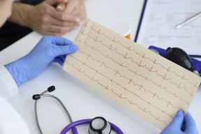 ekg.jpg