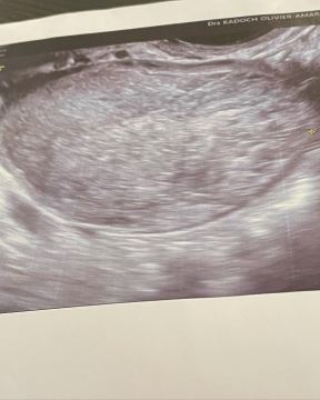 Wasn’t sure about posting this  but here we are  A year ago I had an emergency operation for an ovarian cyst that had exploded in my stomach. 3 months after, my belly started to hurt again and  at the  (4).jpg