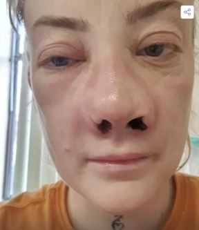 2025-06-04 14_26_33-FOTO Glazbenica otišla u Tursku ugraditi zubne implantate, a onda je počeo horor.png