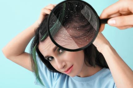 stockphotolookingatwomanshairthroughmagnifieronbluebackgroundproblemofdandruff2151683999.jpg
