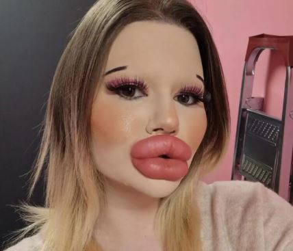 20241212-14-42-19woman-with-worlds-largest-lips--andrea-ivanova-has-biggest-lips--who-is-andre.jpg