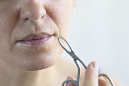 stock-photo-woman-tweezing-hair-from-her-mole-on-upper-lip-2557272713.jpg