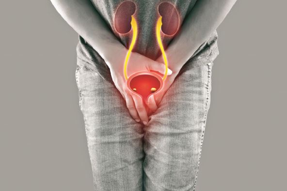 stockphotoamanhavingurethritismalewithhandsholdinghercrotchbladderstonesinmen2024357333.jpg