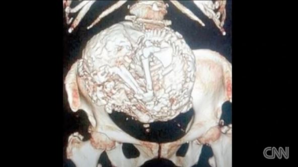 staricanosilausebi50godinafetus-4.jpg
