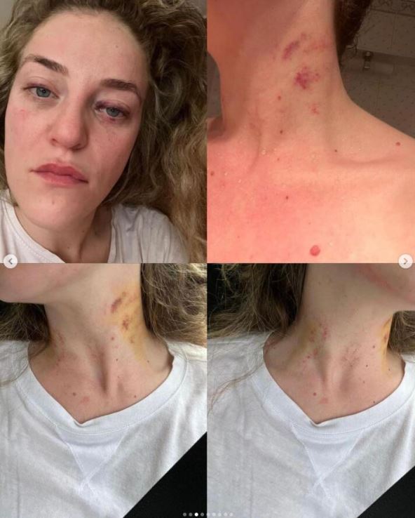 20240327-11-18-13nada-grujicic--nadagrujicic6--instagram-photos-and-videos.jpg
