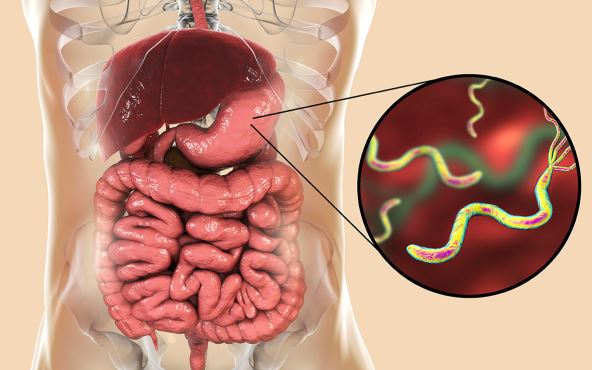 stockphotohelicobacterpyloribacteriumcolonizingstomachandassociatedwithgastricandduodenalulcer1024526272.jpg