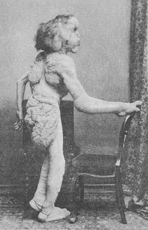 elephantman2.jpg