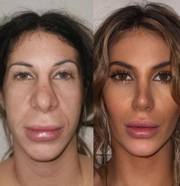 plasticne-operacije7.jpg