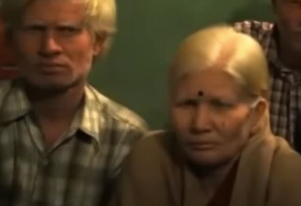 albino2.jpg