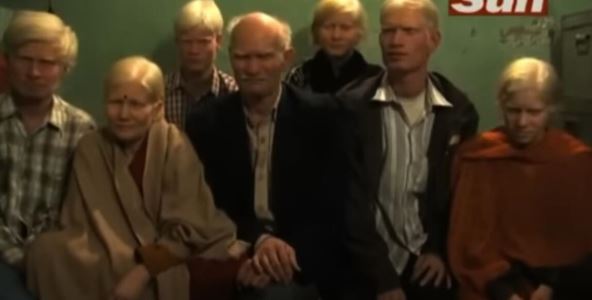 albino.jpg