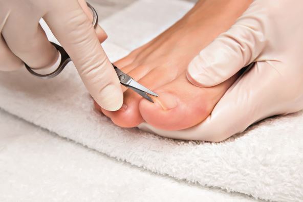 SECENJE NOKTIJU  stock-photo-hands-in-gloves-cares-foot-nails-pedicure-beauty-salon-foot-fingernails-cutting-with-scissors-587690882.jpg