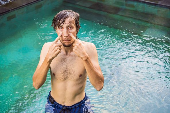 NE RONITE OTVORENIH OCIJU stock-photo-the-man-has-red-eyes-after-the-pool-1398205994.jpg