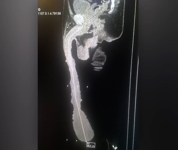 2025-11-06 13_50_10-The Man With The Half-Metre Penis - YouTube.png