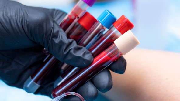KRVNA SLIKA  stock-photo-drawing-blood-with-tubes-laboratory-technician-drawing-blood-with-a-sample-holder-in-the-clinical-2509205015.jpg