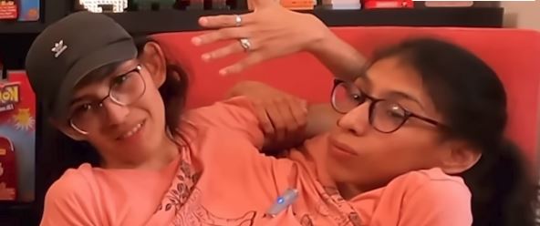 Sijamske bliznakinje