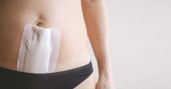 PRVE DVE NEDELJE KLJUCNE ZA OPORAVAK    stock-photo-woman-recovering-abdomen-after-gynecological-operation-hysterectomy-or-laparotomy-covered-with-2587993205.jpg