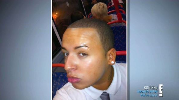 Džordan Park pre operacija