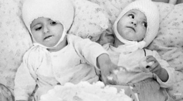 sijamske bliznakinje (4).png