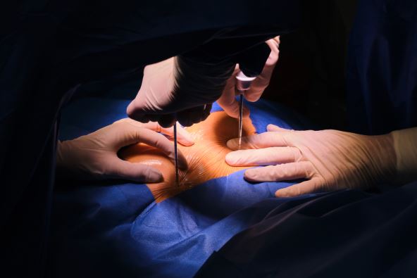 Biopsija koštane srži