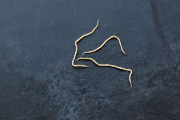 stock-photo-threadworms-parasites-on-black-background-copy-space-1616038420.jpg
