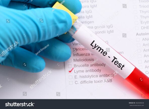 ANTRFILE LAJMSKA BOLEST   stock-photo-blood-sample-for-lyme-disease-testing-482600638.jpg