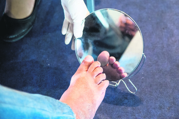 REDOVNO PREGLEDAJTE STOPALA  stock-photo-rio-de-janeiro-brazil-november-health-professional-teaches-patient-to-look-at-foot-519863590.jpg