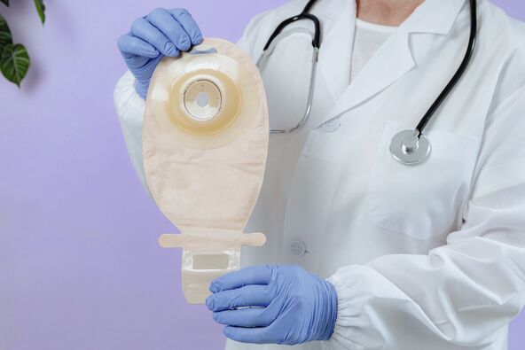STA JE STOMA   stock-photo-an-elderly-doctor-in-a-white-coat-holds-a-colostomy-bag-2712187955.jpg