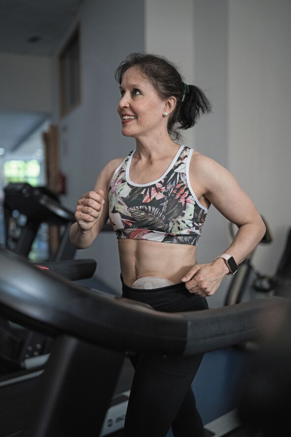 OSOBE SA STOMOM NE MOGU DA VEZBAJU   stock-photo-woman-running-on-a-treadmill-actively-recovering-and-building-fitness-after-surgery-showing-2692920041.jpg