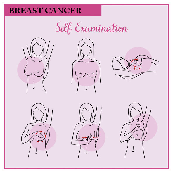 stock-photo-breast-cancer-medical-infographic-self-examination-women-s-health-set-breast-cancer-awareness-1481041568.jpg