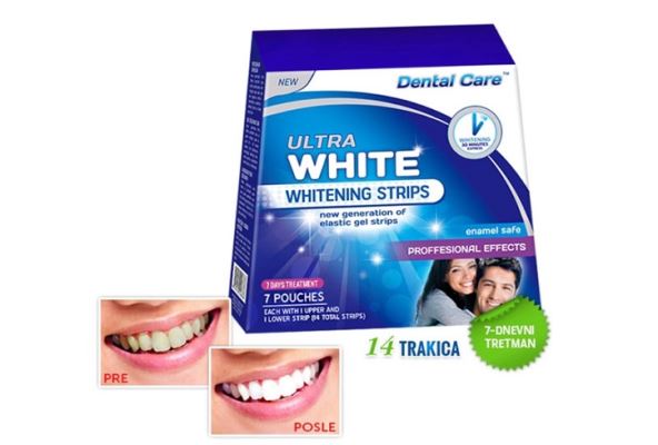 ultra-white-trake-za-izbeljivanje-zuba.jpg