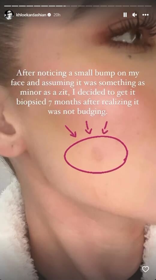 hrt.jpg