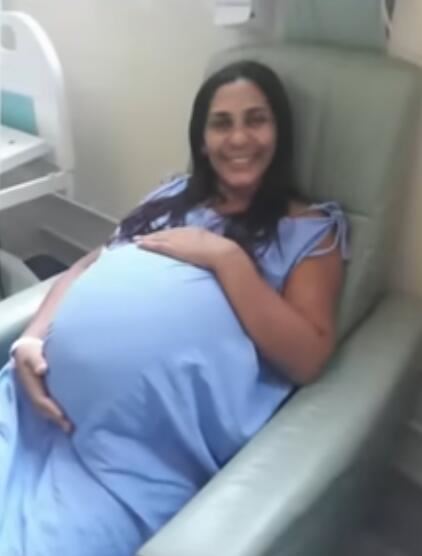 20250227-14-29-45gmeos-que-nasceram-unidos-pela-cabea-fazem-cirurgia-31-07-2022--youtube.jpg